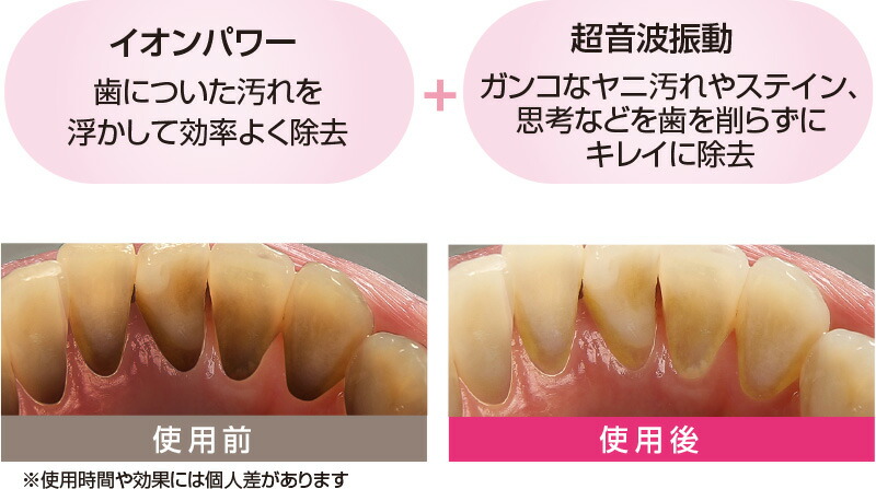 イオンソニック
